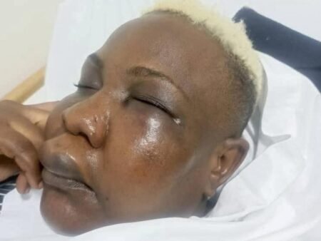 Ugandan presidential advisor Full Figure hospitalized after brutal assault