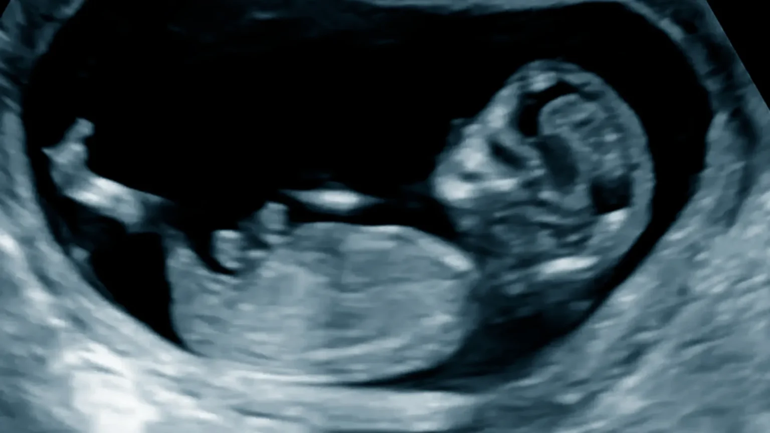 'Stillborn' baby found alive after mother killed in hit-and-run accident