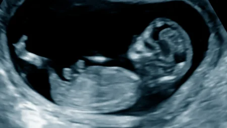 'Stillborn' baby found alive after mother killed in hit-and-run accident