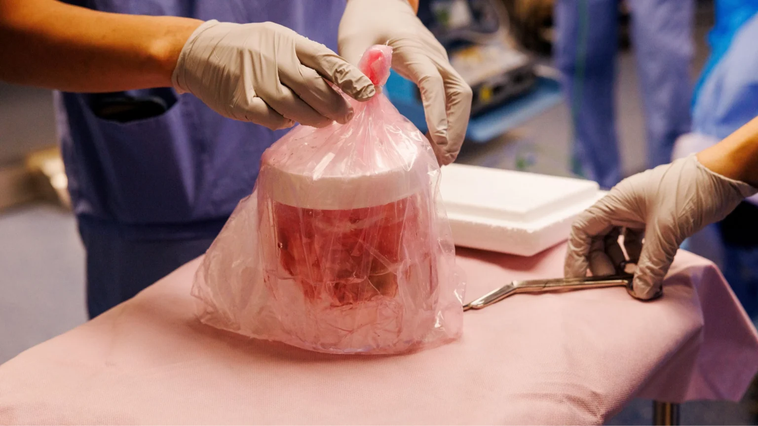 Pig kidney transplant keeps patient off dialysis for record 271 days Pig kidney transplant keeps patient off dialysis for record 271 days